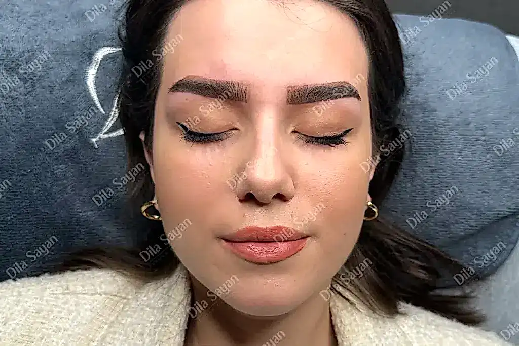 Altın oran kaş alımı