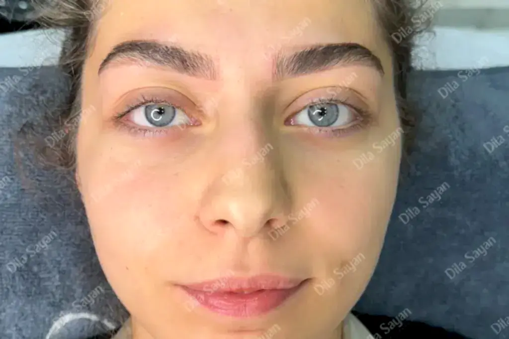 Altın oran kaş işlemi