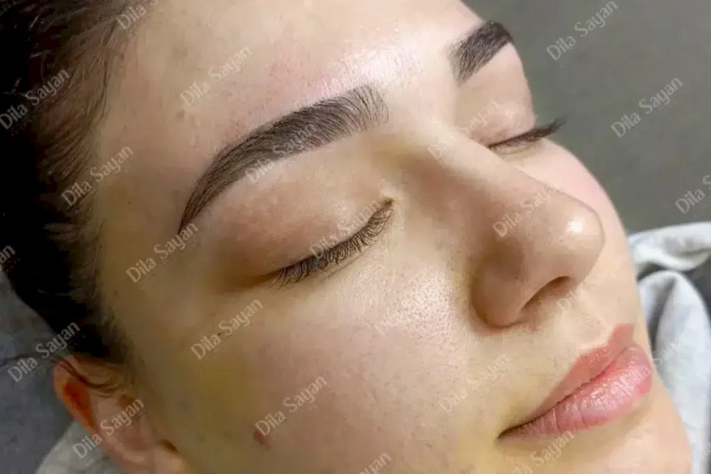 Altın oran kaş alımı işlemi sonrası görünüm