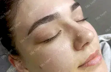 Altın oran kaş alımı işlemi sonrası görünüm